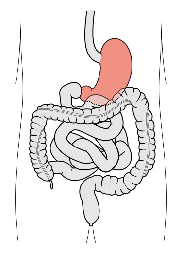 File:Stomach.png