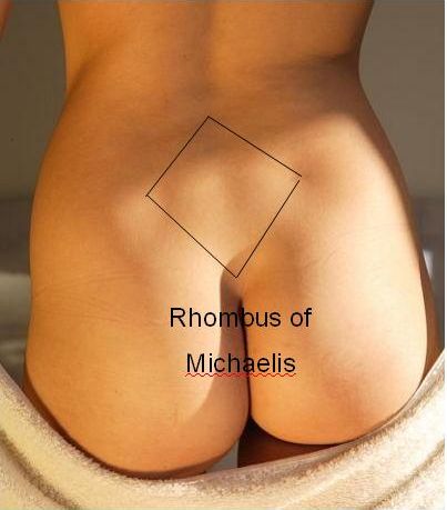 File:Back-rhombus.jpg