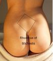 Rhombus of Michaelis